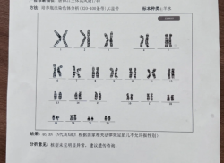 我的试管之路：染色体异常检查，两家医院结果大不同！