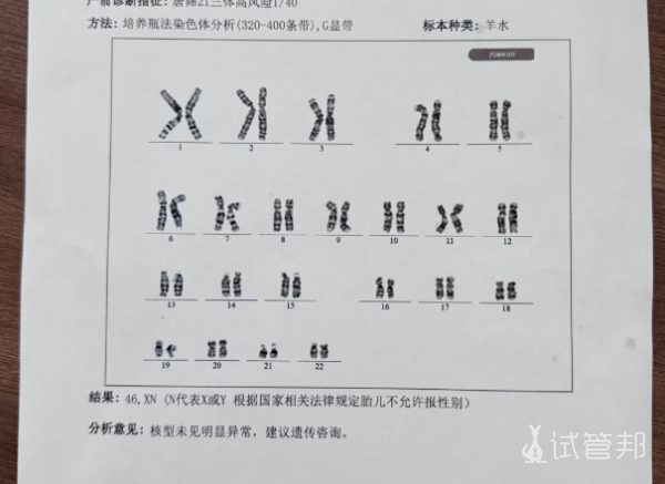 0e7028d2b95d8246509ffe5faff5d286.png 我的试管之路染色体异常检查两家医院结果大不同
