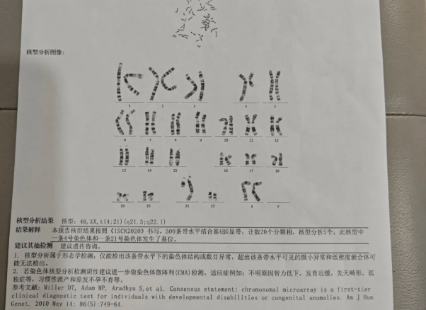 30ba41ae4870b3c4a2cd89f3b55f15d2.png 两次染色体异常后我如何自怀成功