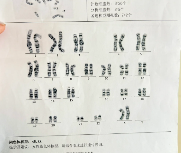 染色体核型报告大揭秘