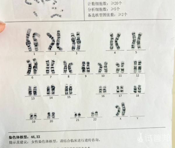 54fe60087a17411c65fc99c37631f7dc.png 染色体核型报告大揭秘