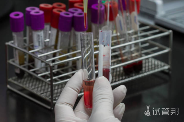 6b0e6a15adc31cef784d177c3d2b70f3.png 人工授精前要做什么检查