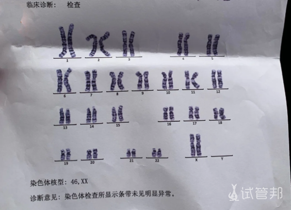 70720b982cd429774456c4cfa66f7f94.png 染色体检测攻略来啦