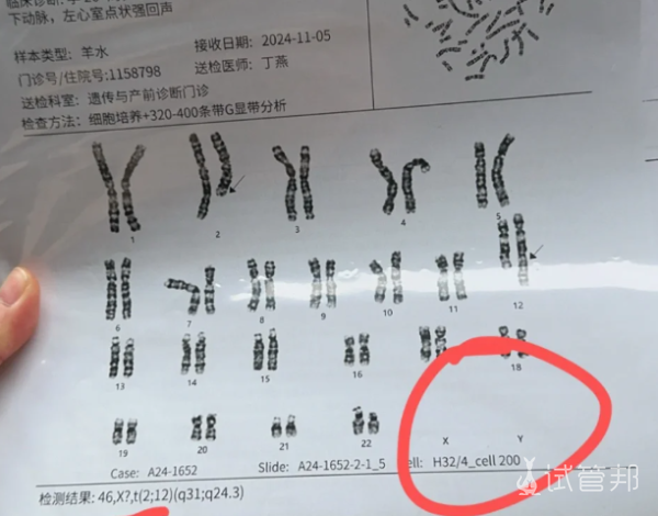 70f96e61c5a4cc1535aa1f43ebdf092a.png 外周血染色体核型分析你的健康守护神