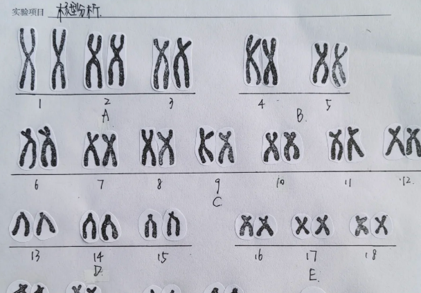 99840743643840e0200c7666e5e69678.png 染色体核型报告大解密