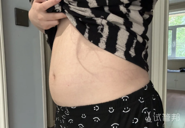 3dd1809d0bf47cdf2aeb5c5f86e84a08.png 已育宝妈来揭秘我的试管求子之路