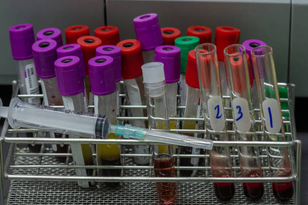 ab85cede0d4125518f24927335f9e426.png 人工授精放到哪个位置