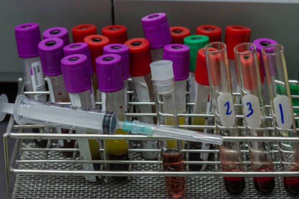 afeee827fe499c7dc958f587e4e909df.png 人工授精和试管婴儿有什么不同