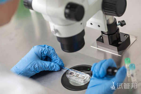 3202beffdf21643dcdcd31aa8d7061df.png 取卵手术全流程是怎样的