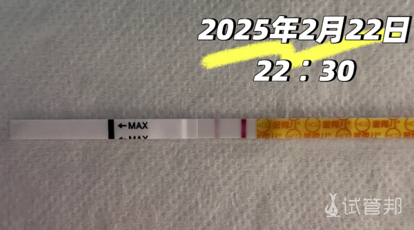 3f01bedfcd382291c7a5e4f7d81a70b0.png 来说一说我试管婴儿取卵时疼不疼