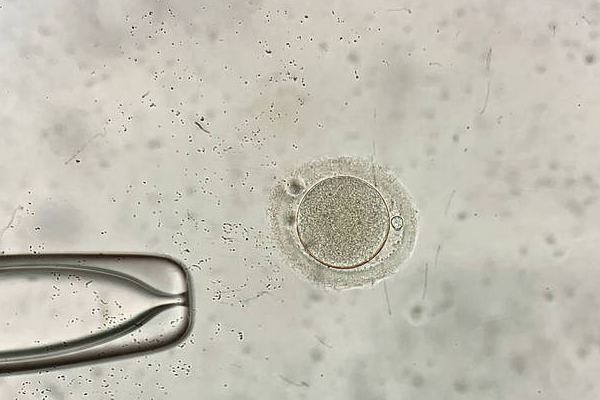 49971144cbe9e2bb055af936e6e0cce3.png 取卵疼不疼