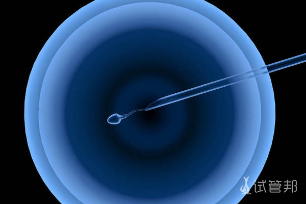 43246c1d65ad9152086ae28cbdfe39ea.png 取卵后什么时候可以同房