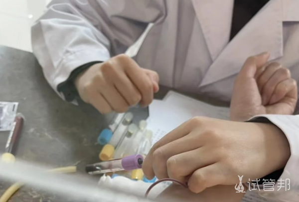 17768d07e5245b2eb2b7b08b4a5c73e0.png 40+高龄备孕这些检查项目必不可少