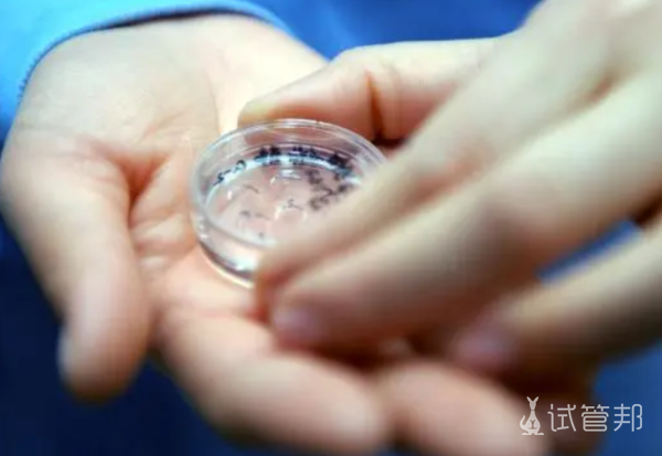 22f4d6ffd37cfa0aae54d7b1c58aa926.png 胚胎移植三天后有什么反应