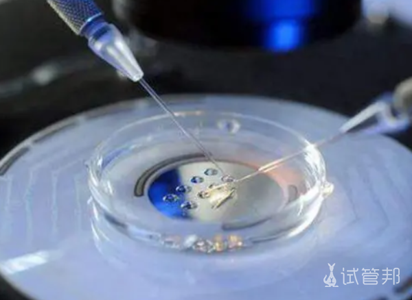 44f5f72a62df63303d438d333d2775c5.png 胚胎移植的全过程