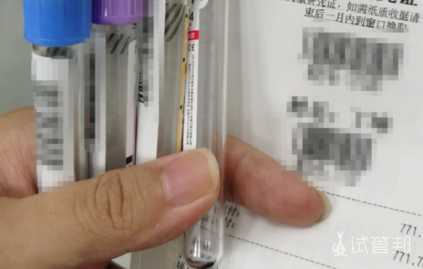 4f80ebf0fdb85bd71aa62e56ed69b6f8.png 试管之路峰回路转我终于迎来了我的蛇宝宝们