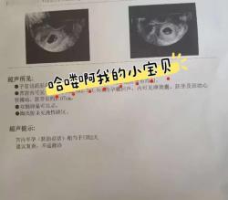试管婴儿一促一移成功好孕，希望好孕传递给你们
