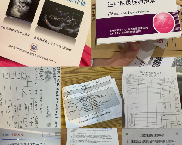 衡水市人民医院试管经历续章