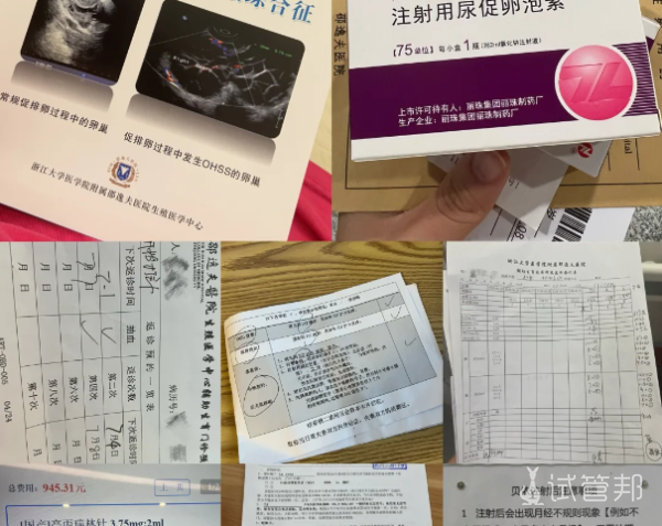 7dc8af2c15b2d4c6b64e24bc3b227d30.png 衡水市人民医院试管经历续章