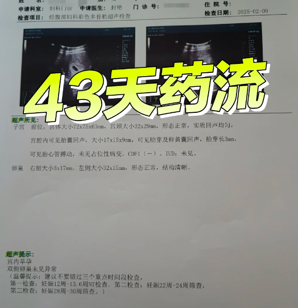 意外怀孕43天药物流产的经历分享