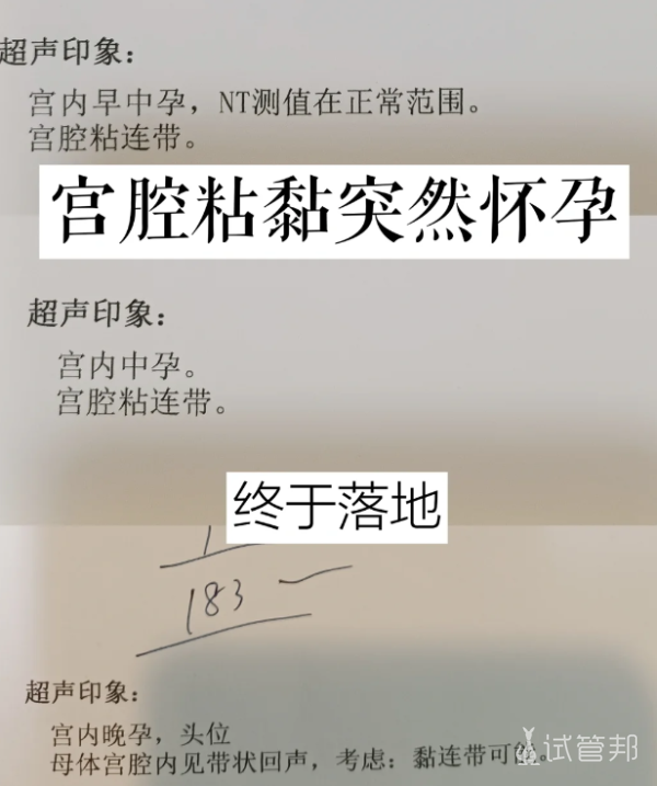 27d9f6a86e34b53a0c9002db99468838.png 宫腔粘连真的还能怀孕