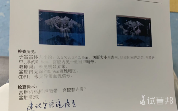 c8edc9dfd1caaab9c7aa9af370a4cb2f.png 宫腔粘连怎么治疗