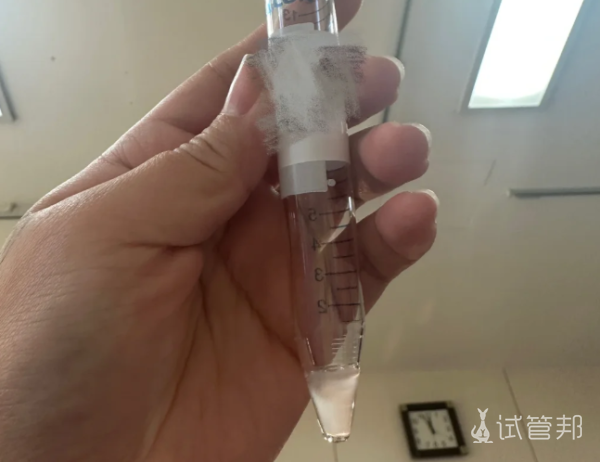 21b0dab81efcfc469b8d5d562758ddd3.png 致正在或即将踏上试管的姐妹们我已迈入13周的幸福大门啦