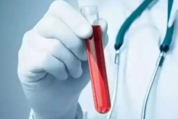 b2c94a9b3a7a67246a3d97495e7278a8.png 白血病早期的8个征兆