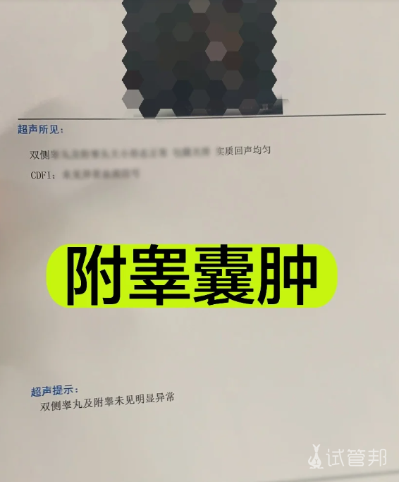 df0e6ea6eec3748704dee92174fdc122.png 附睾囊肿治疗经历分享