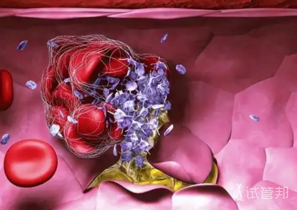 e2c504086a589151445953d61e39f8f6.png 白血病一般治疗费用多少