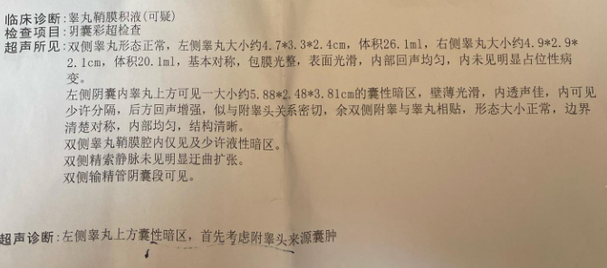 附睾囊肿男性都要多加注意