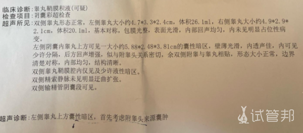 ede0eb8e02359db7fe3d3f09b7b28372.png 附睾囊肿男性都要多加注意