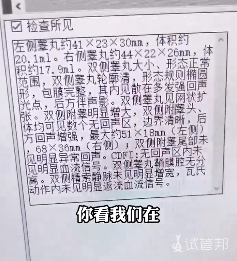 f14e226c0e8a01b9e9bd7e438905890f.png 附睾囊肿竟然是备孕失败的原因