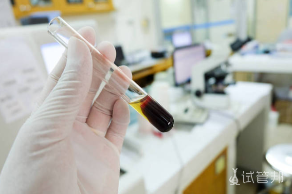 31eac50900cd980f379aa84ecbfab1aa.png 乙肝两对半定量是什么意思