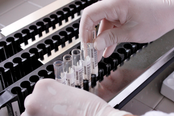 52c19cf971c436a89fe8b23a229e35b9.png 乙肝两对半245阳性指的是什么