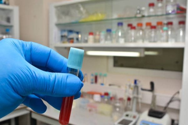 7d5334bd2b17d54ac30ffa33dbf15a66.png 乙肝两对半全阴性正不正常