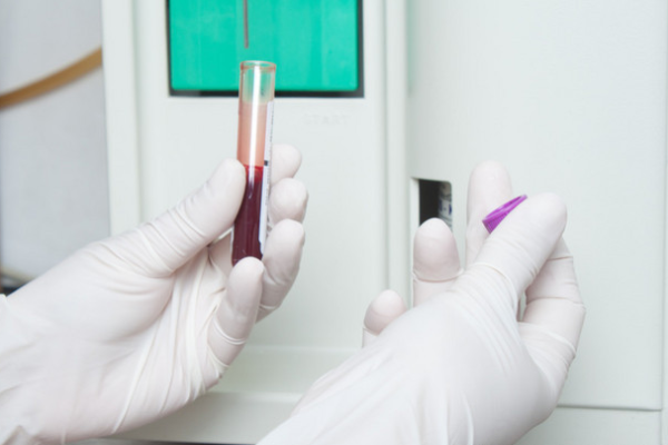 8f7d77df43e09668daff1c88bb687def.png 乙肝两对半检查报告怎么解读