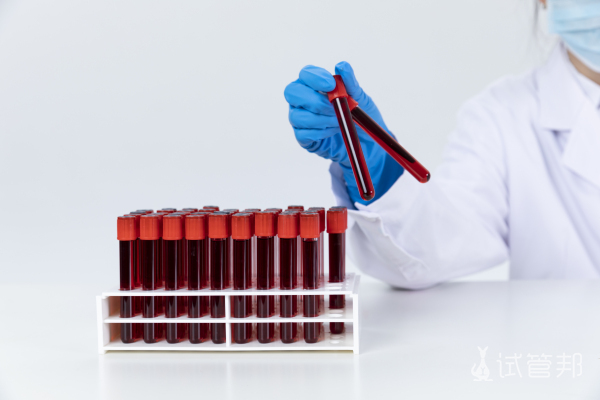 93a7bf3b53d45007e4ef41c4c24ea257.jpg 乙肝两对半全部是阴性是正常的吗