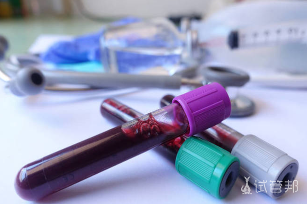 989d93f6c6d548acaac7cc8586d8b83e.png 乙肝两对半检查在哪个科室