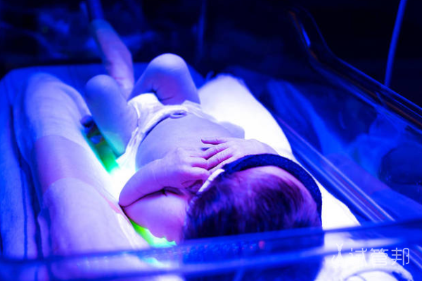 1b707430004ee62ea3d9b9a365aed5e7.png abo溶血症发生概率是多少