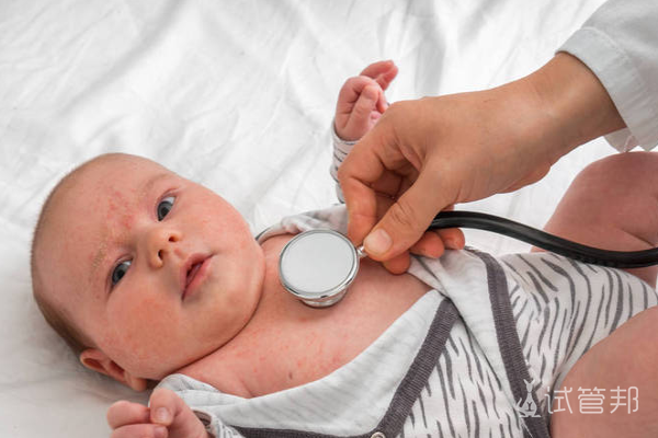 1f10b41da267726fc382c37484edd165.png abo溶血症该怎么检查