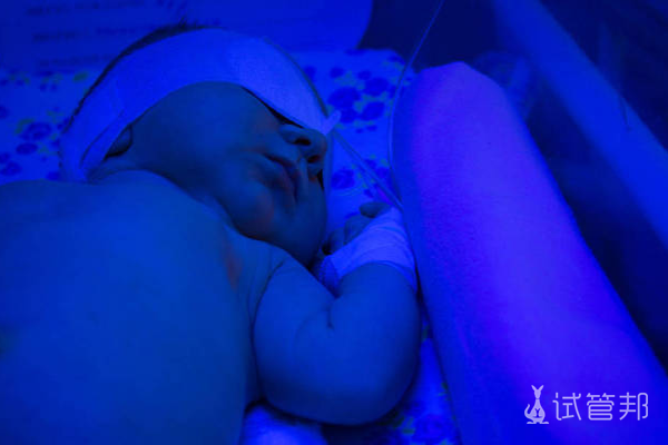 49f73fe1f28d458b1fb95f4ccf323b26.png abo溶血症光疗作用有哪些