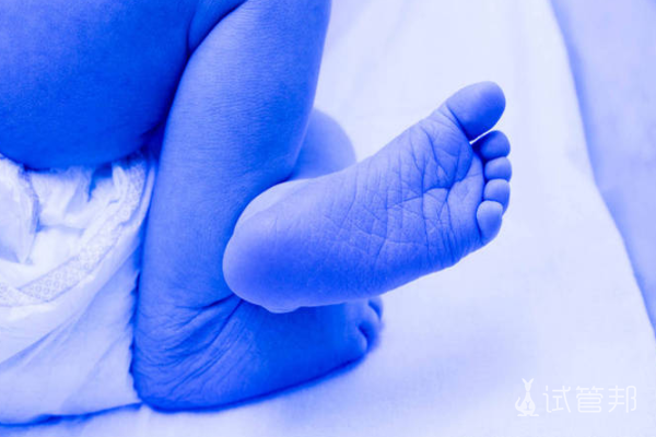 760fb764d2ab18371bc4eb690f094713.png abo溶血症对新生儿影响大吗