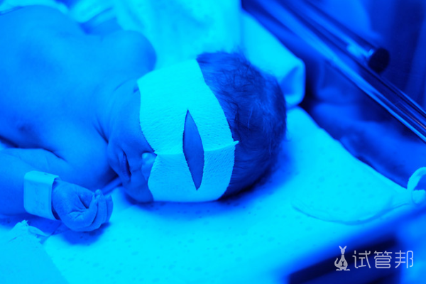 79ca9caa0069549cb3e703ee123a64f0.png 什么是abo溶血症