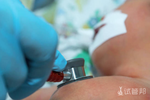 d7d670cc3ea370d194b4701429bca443.png abo溶血症会发生后遗症吗