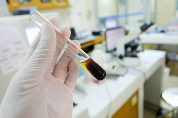 52dffe0fc9ac85cbb43d30074364725e.png 熊猫血能输血给任意人吗