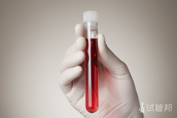 5bca3e241851d6db1976801824aa2cc5.png 熊猫血rh是阴性还是阳性