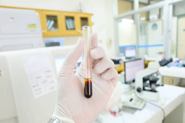 5fc99bd76597c4842eb1674fd7a1a8bb.png 熊猫血危险吗