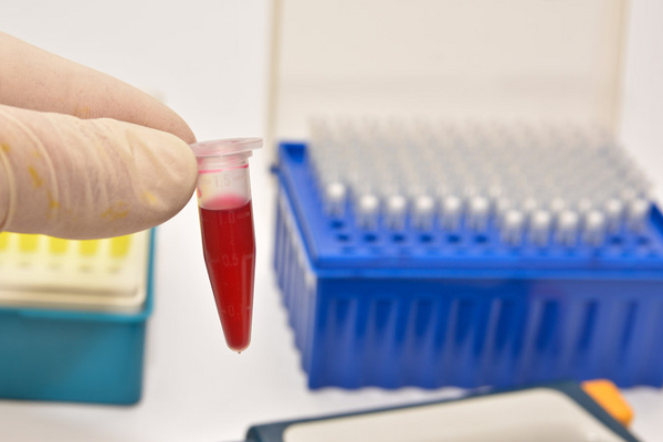 679d0d03c23722fff62b98e33f909196.png 熊猫血会不会遗传