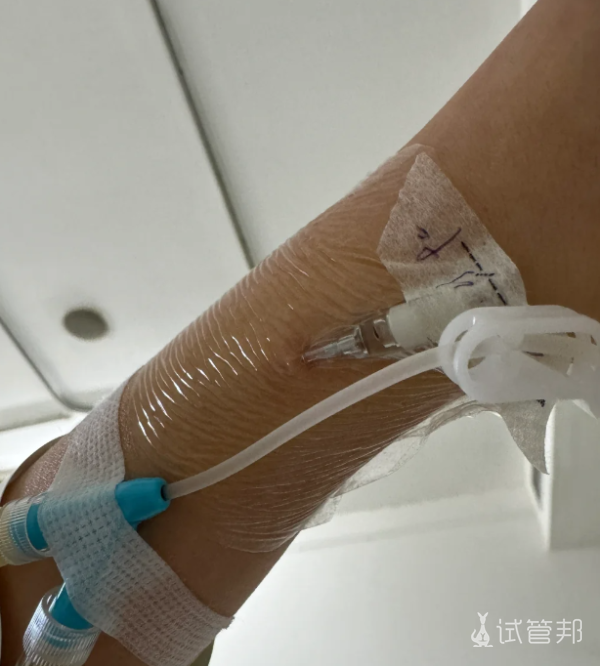 9f8d30fdaf4c6795899acfc88f0c5e8a.png 检查出宫颈粘连住院准备手术